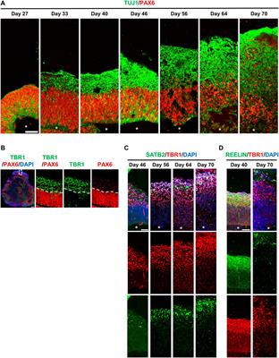 Modeling Human Primary Microcephaly With hiPSC-Derived Brain Organoids Carrying CPAP-E1235V Disease-Associated Mutant Protein